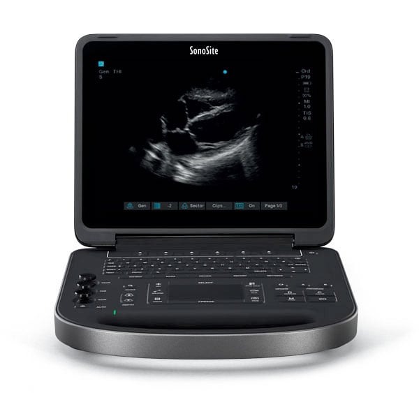 ultrassom portatil fujifilm sonosite edge II