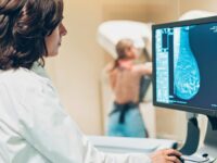 mamografia bilateral